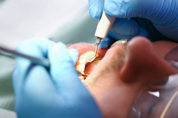 Best Knocked-Out Tooth Emergency  in Maan, ND